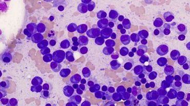 2021-01_myelom
